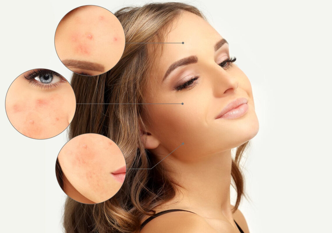 1-dermatologia-marina-conese