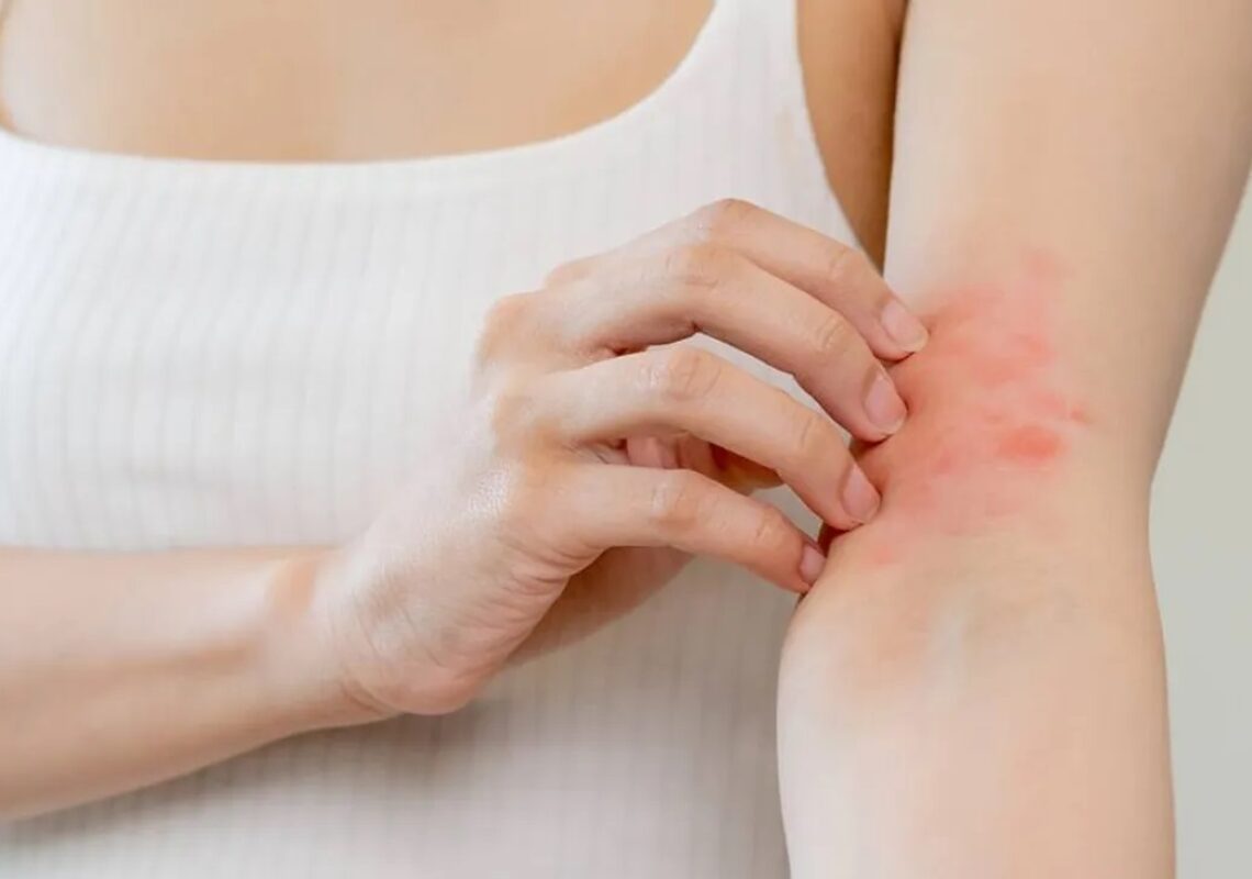 6-dermatologia-acne-eczema-psoriasi-trattamenti-dermatologici-pelle-marina-conese