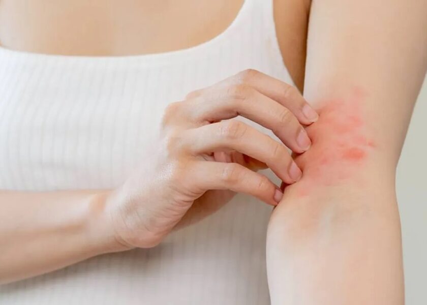 6-dermatologia-acne-eczema-psoriasi-trattamenti-dermatologici-pelle-marina-conese