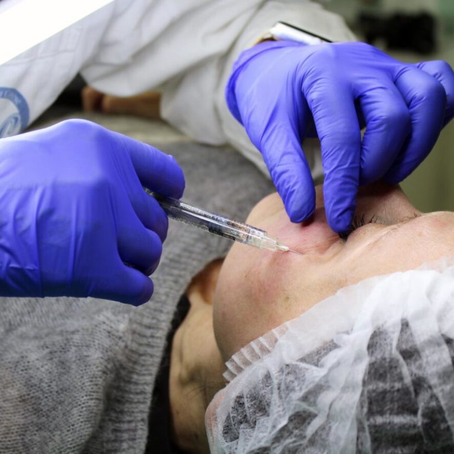 Risultati dopo trattamento sinergico topico + fotobiomodulazione dopo due mesi