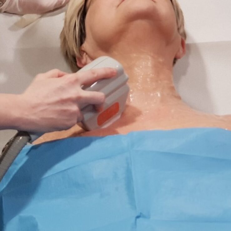 Trattamento con IPL per ringiovanimento del collo
