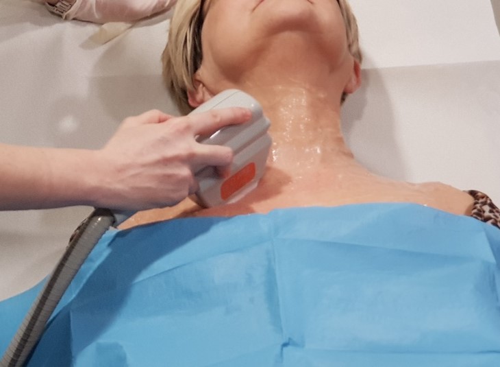 Trattamento con IPL per ringiovanimento del collo