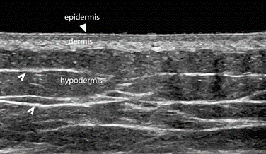 9. ECOTOMOGRAFIA DERMATOLOGICA E DI MEDICINA ESTETICA