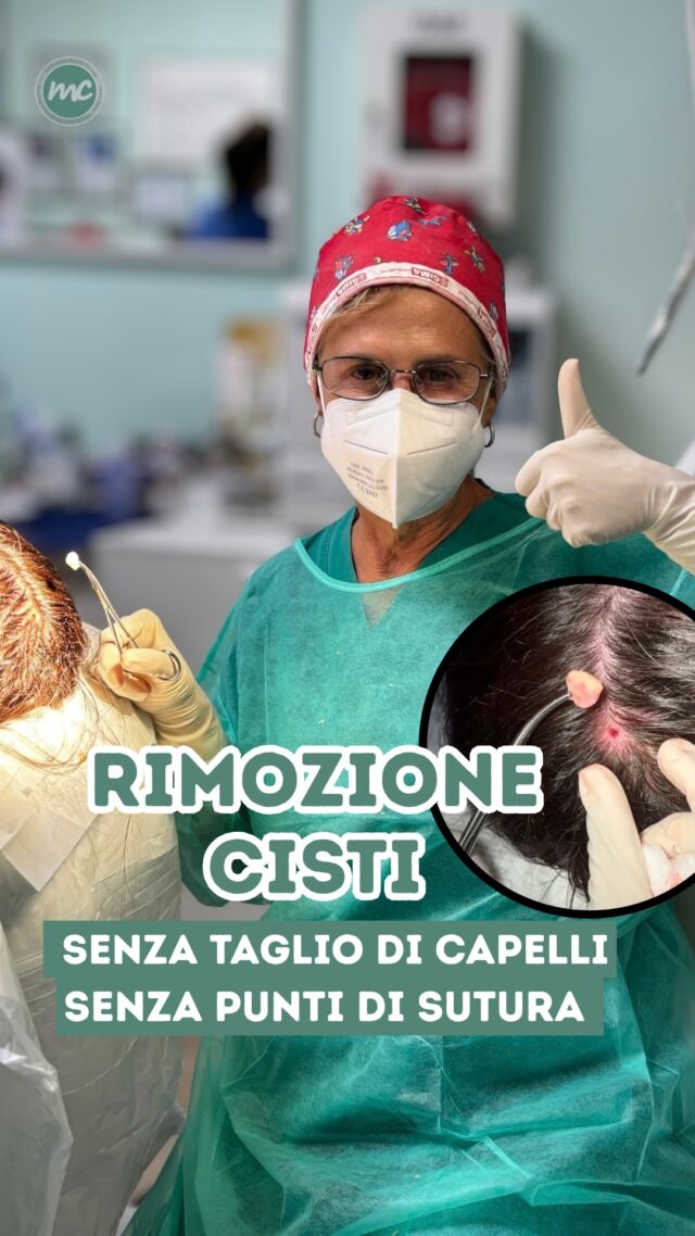 Altro giorno, altra rimozione CISTI!

Sempre con il mio metodo chirurgico minimamente invasivo e quindi :

- SENZA tricotomia (no taglio di capelli)🚫✂️
- SENZA punti di sutura 🚫🪡

PROCEDURE TERAPEUTICHE INNOVATIVE PERCORSO ACNE E RIMOZIONE CISTI SEBACEE DOTT.SSA MARINA CONESE™️

📍Via Raffaele De Cesare 15, Bari
📞 𝟥𝟩𝟨 𝟣𝟣𝟧𝟣𝟪𝟤𝟨 (acne) / 𝟥𝟦𝟪 𝟨𝟣𝟢𝟥𝟦𝟨𝟣
☎️ 𝟢𝟪𝟢 𝟩𝟫𝟨𝟥𝟥𝟦𝟫

#dottssamarinaconese #dermatologia #influencer #bari #puglia #new